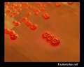 escherichia coli